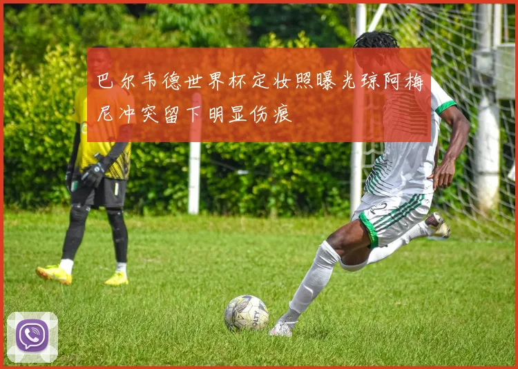 巴尔韦德世界杯定妆照曝光琼阿梅尼冲突留下明显伤痕